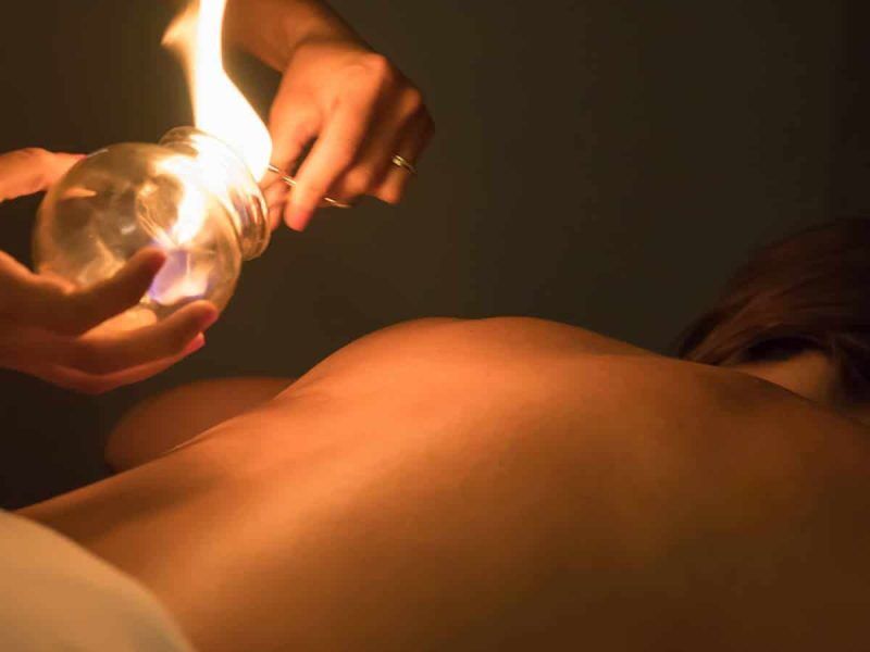 cupping-treatment heated glass cups